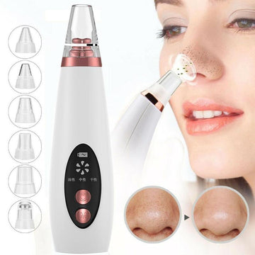 Blackhead Remover Pore Vacuum – Nose & Acne Suction Tool - Lumina